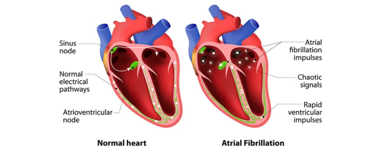 Arrhythmia Clinic